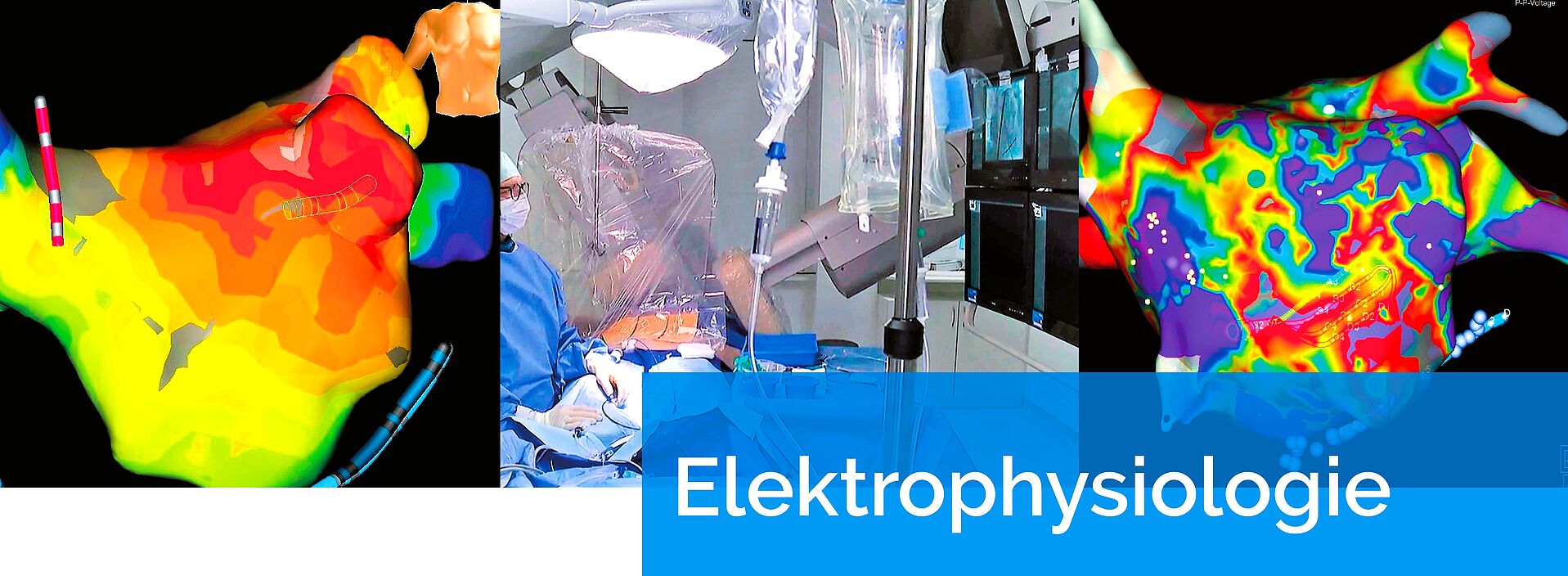 Elektrophysiologische Abteilung an der Kerckhoff-Klinik